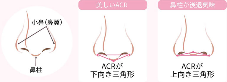 鼻柱下降術が適している方