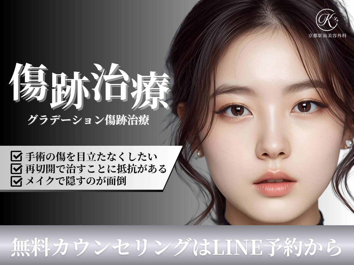 切らない傷跡治療（グラデーション傷跡治療）についてのコラムです（京都駅前美容外科のコラム）