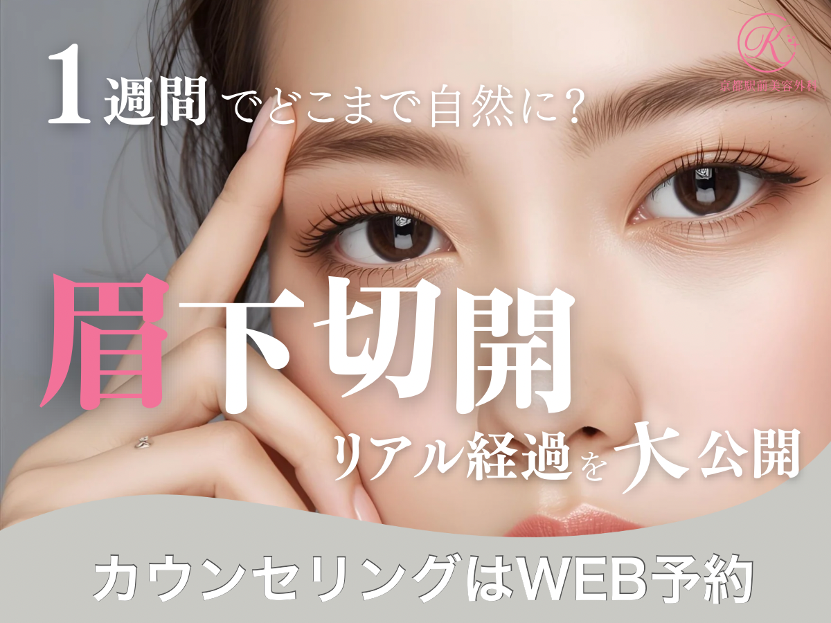 眉下切開のリアルな1週間ダウンタイム経過は?