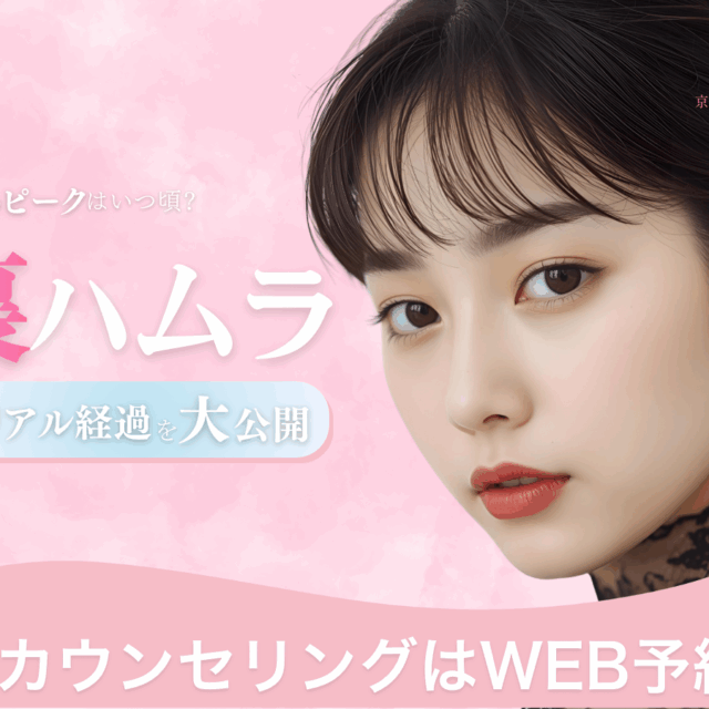 裏ハムラのリアルな１週間経過を公開！（京都駅前美容外科のコラム）