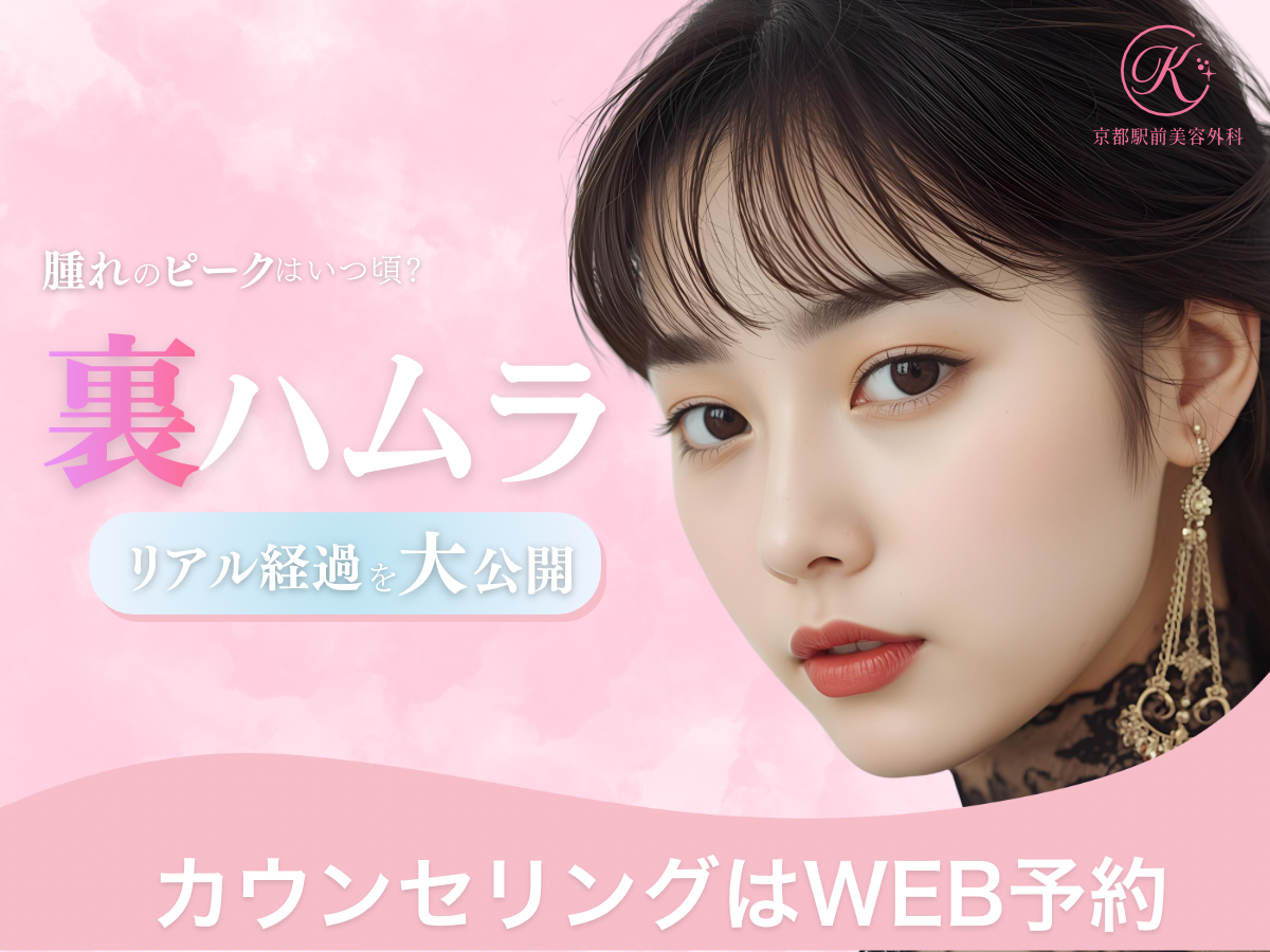 裏ハムラのリアルな１週間経過を公開！（京都駅前美容外科のコラム）