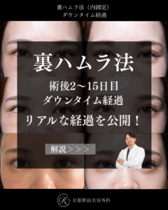 裏ハムラ法のダウンタイム経過(京都駅前美容外科のコラム)