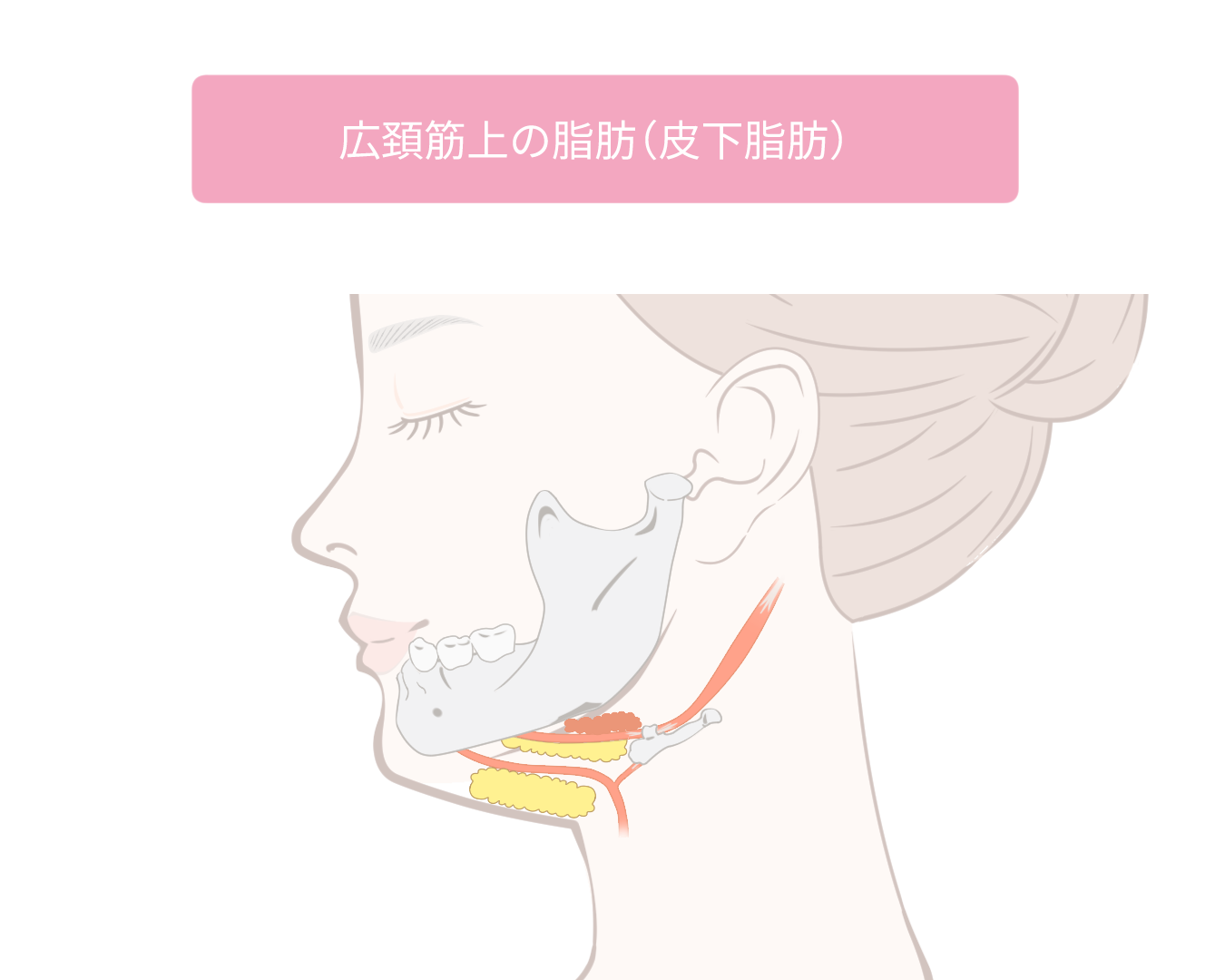 広頚筋上の脂肪(皮下脂肪)