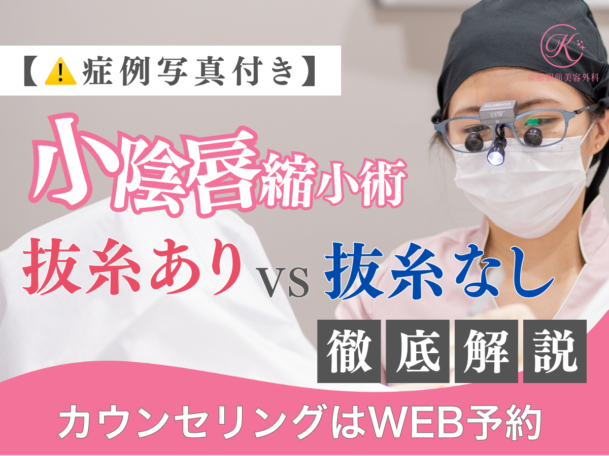 【症例写真】小陰唇縮小術の抜糸あり、抜糸なしの違いとは?婦人科形成専門女医が徹底解説!