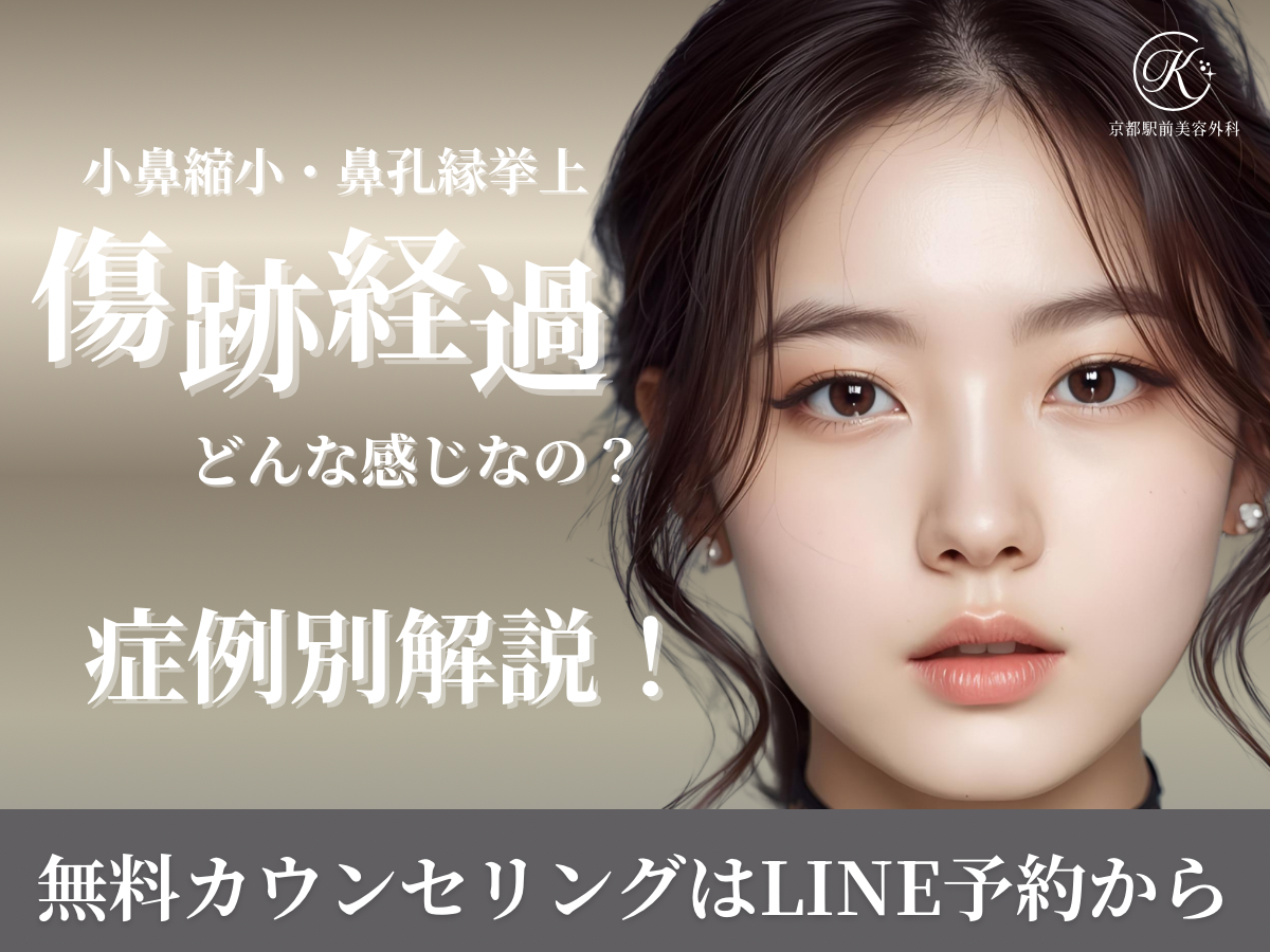 小鼻縮小・鼻孔縁挙上の傷跡経過、どんな感じ？症例別に解説！（京都駅前美容外科の医療コラム）