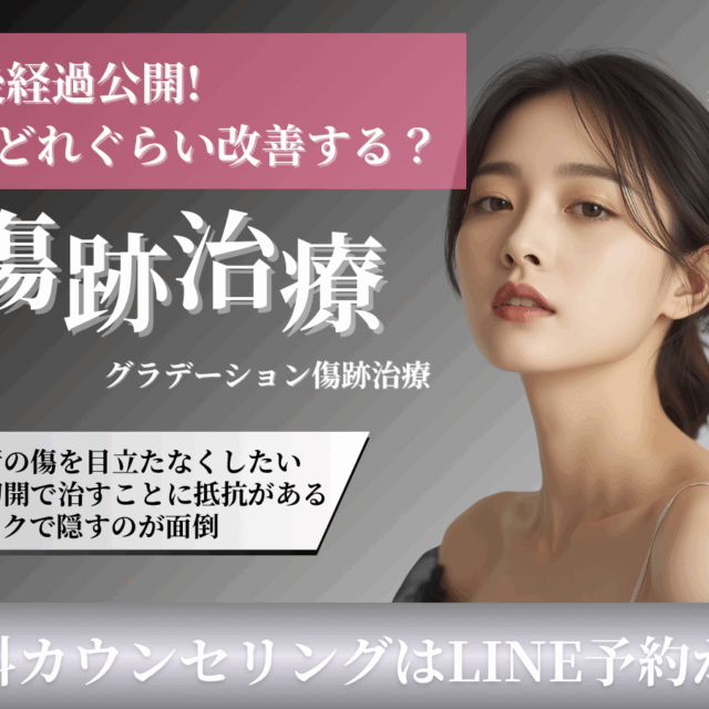 グラデーション治療の術後経過公開！京都駅前美容外科の医療コラム