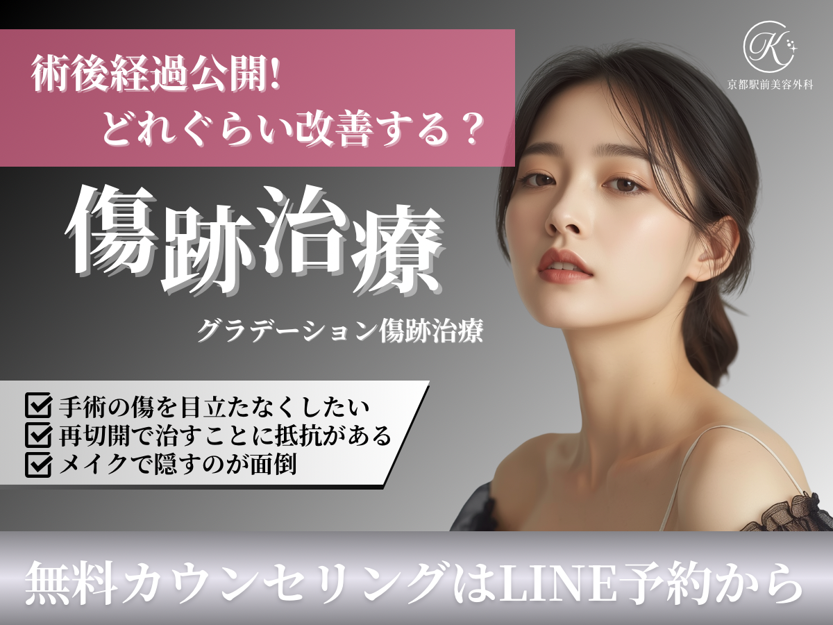 グラデーション治療の術後経過公開！京都駅前美容外科の医療コラム