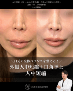人中短縮、外側人中短縮＋口角挙上、鼻柱下降、耳軟骨移植の術後経過。京都駅前美容外科の症例画像