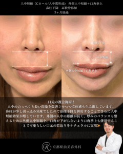 人中短縮、外側人中短縮＋口角挙上、鼻柱下降、耳軟骨移植の術後経過。京都駅前美容外科の症例画像