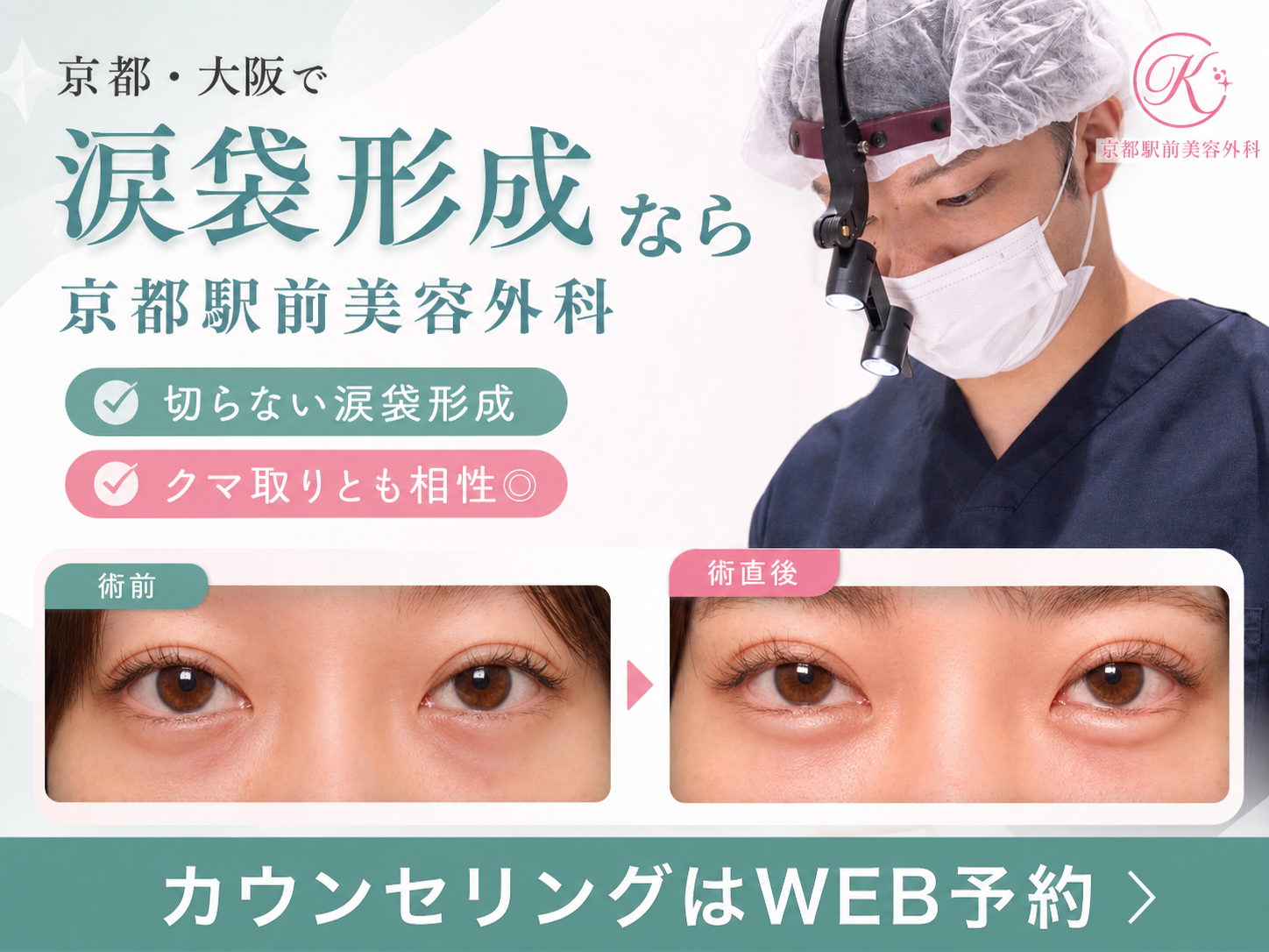 京都・大阪で涙袋形成なら京都駅前美容外科。京都駅前美容外科の医療コラム。