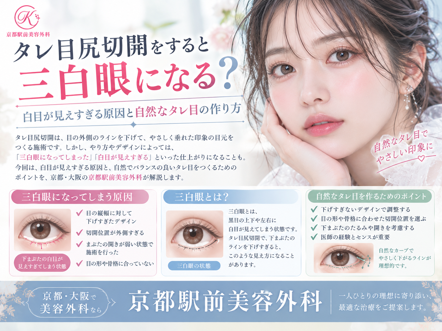 タレ目尻切開をすると三白眼になる?白目が見えすぎる原因と自然なタレ目の作り方|京都・大阪の京都駅前美容外科。京都駅前美容外科の医療コラム。