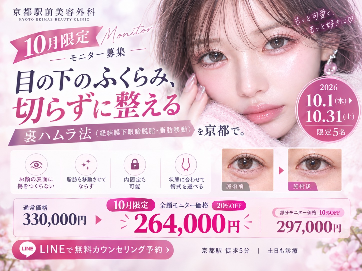 裏ハムラキャンペーン
